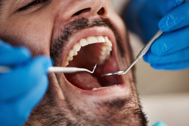 Best Emergency Tooth Extraction in Orangeburg, NY